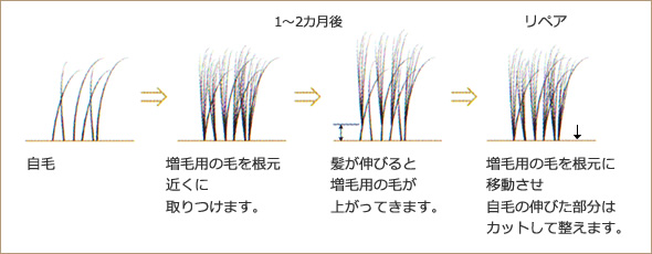 施術の流れ